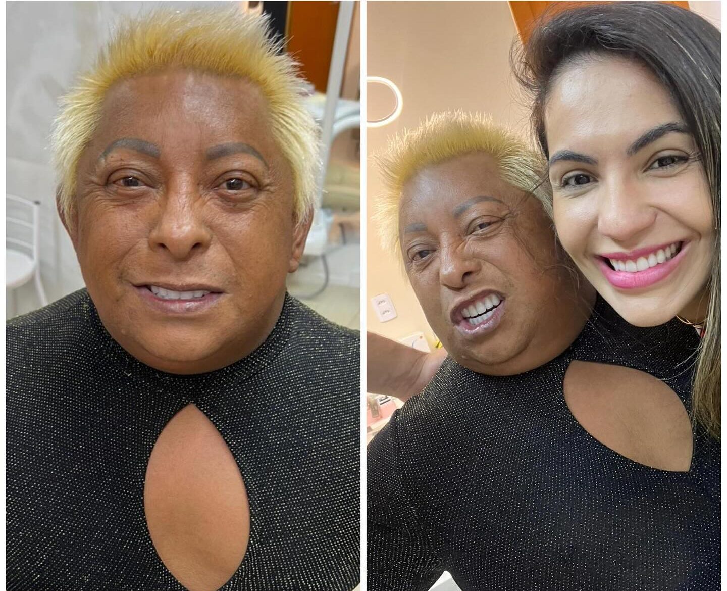 Imagem destacada do post: Patixa exibe novo sorriso após procedimento em Goiânia; veja vídeo